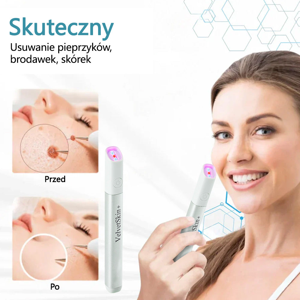 ✨ Bikenda®  – Laserowy Długopis CO₂ do Usuwania 🟤 Znamion, 🦠 Brodawek, 🔘 Przebarwień i Innych Niedoskonałości Skóry