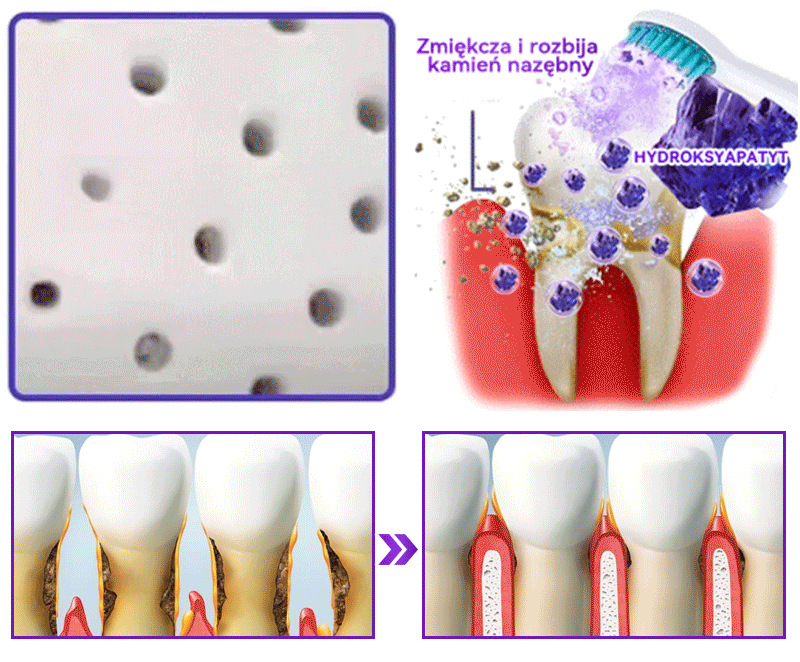 Proszek do regeneracji i naprawy zębów 𝐷𝑜𝒓𝒎𝒐𝒓𝑛𝑎® z hydroksyapatytem 🦷 (skutecznie naprawia ubytki zębów, problemy z dziąsłami, nadwrażliwość zębów, owrzodzenia jamy ustnej i żółknięcie zębów, kompleksowo poprawiając zdrowie jamy ustnej) 🍀