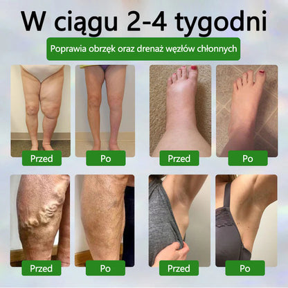 🌿🌿🌿Dorina® Krem ziołowy łagodzący obrzęki z czarnuszką