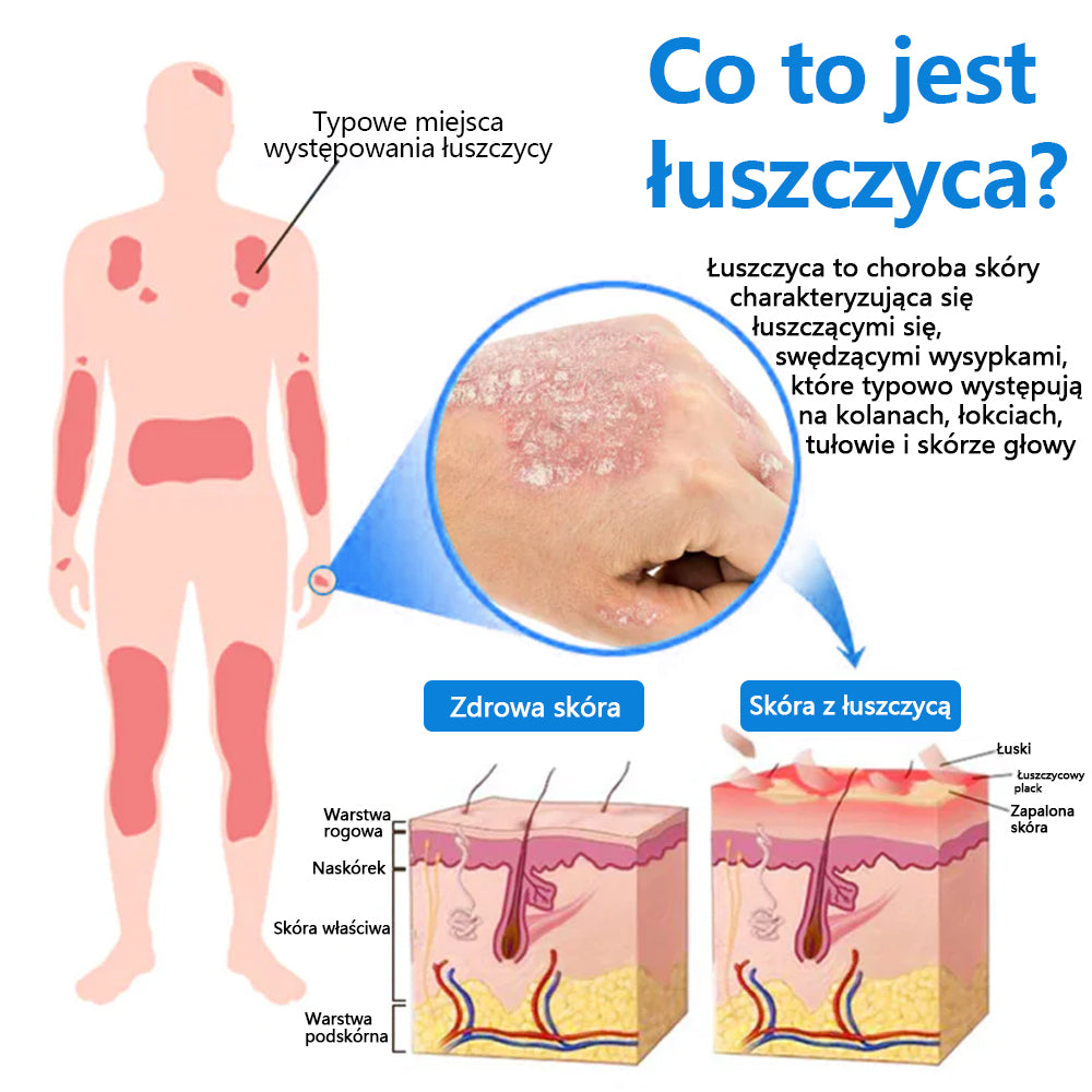 Oficjalny sklep✅: CleraLuxe®Magnezowy spray ziołowy na łuszczycę📦