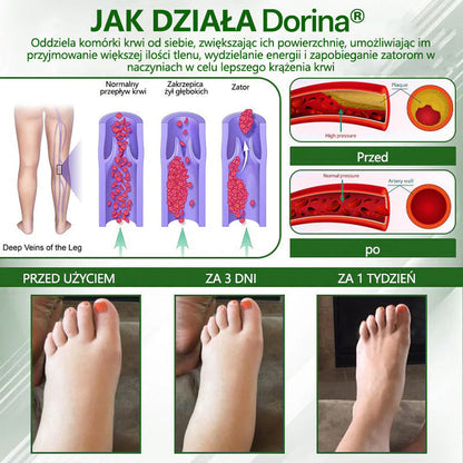 🌿🌿🌿Dorina® Krem ziołowy łagodzący obrzęki z czarnuszką