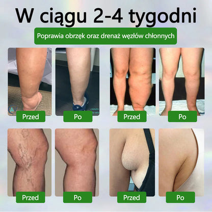 🌿🌿🌿Dorina® Krem ziołowy łagodzący obrzęki z czarnuszką