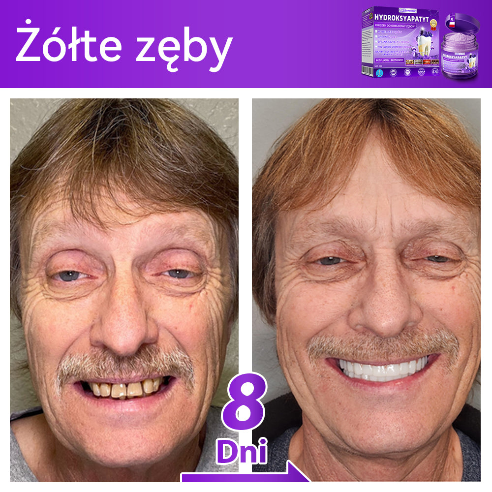 Proszek do regeneracji i naprawy zębów 𝐷𝑜𝒓𝒎𝒐𝒓𝑛𝑎® z hydroksyapatytem 🦷 (skutecznie naprawia ubytki zębów, problemy z dziąsłami, nadwrażliwość zębów, owrzodzenia jamy ustnej i żółknięcie zębów, kompleksowo poprawiając zdrowie jamy ustnej) 🍀