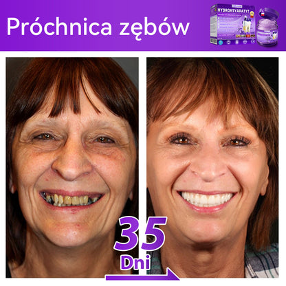 Proszek do regeneracji i naprawy zębów 𝐷𝑜𝒓𝒎𝒐𝒓𝑛𝑎® z hydroksyapatytem 🦷 (skutecznie naprawia ubytki zębów, problemy z dziąsłami, nadwrażliwość zębów, owrzodzenia jamy ustnej i żółknięcie zębów, kompleksowo poprawiając zdrowie jamy ustnej) 🍀