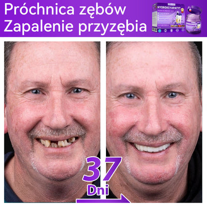 Proszek do regeneracji i naprawy zębów 𝐷𝑜𝒓𝒎𝒐𝒓𝑛𝑎® z hydroksyapatytem 🦷 (skutecznie naprawia ubytki zębów, problemy z dziąsłami, nadwrażliwość zębów, owrzodzenia jamy ustnej i żółknięcie zębów, kompleksowo poprawiając zdrowie jamy ustnej) 🍀