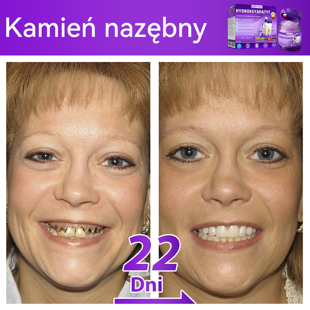 Proszek do regeneracji i naprawy zębów 𝐷𝑜𝒓𝒎𝒐𝒓𝑛𝑎® z hydroksyapatytem 🦷 (skutecznie naprawia ubytki zębów, problemy z dziąsłami, nadwrażliwość zębów, owrzodzenia jamy ustnej i żółknięcie zębów, kompleksowo poprawiając zdrowie jamy ustnej) 🍀