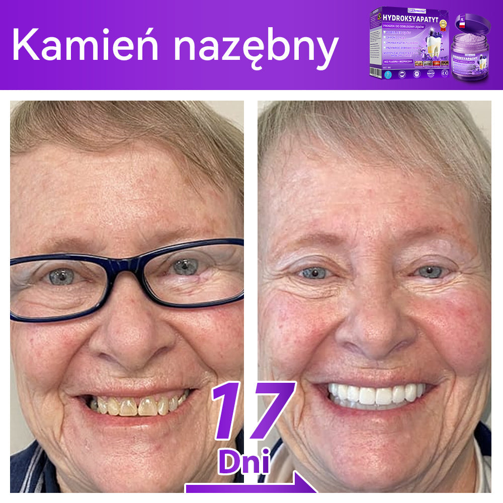 Proszek do regeneracji i naprawy zębów 𝐷𝑜𝒓𝒎𝒐𝒓𝑛𝑎® z hydroksyapatytem 🦷 (skutecznie naprawia ubytki zębów, problemy z dziąsłami, nadwrażliwość zębów, owrzodzenia jamy ustnej i żółknięcie zębów, kompleksowo poprawiając zdrowie jamy ustnej) 🍀