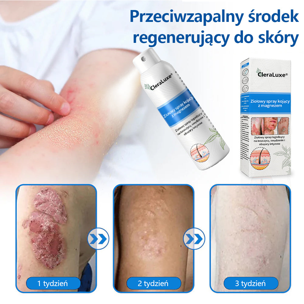 Oficjalny sklep✅: CleraLuxe®Magnezowy spray ziołowy na łuszczycę📦